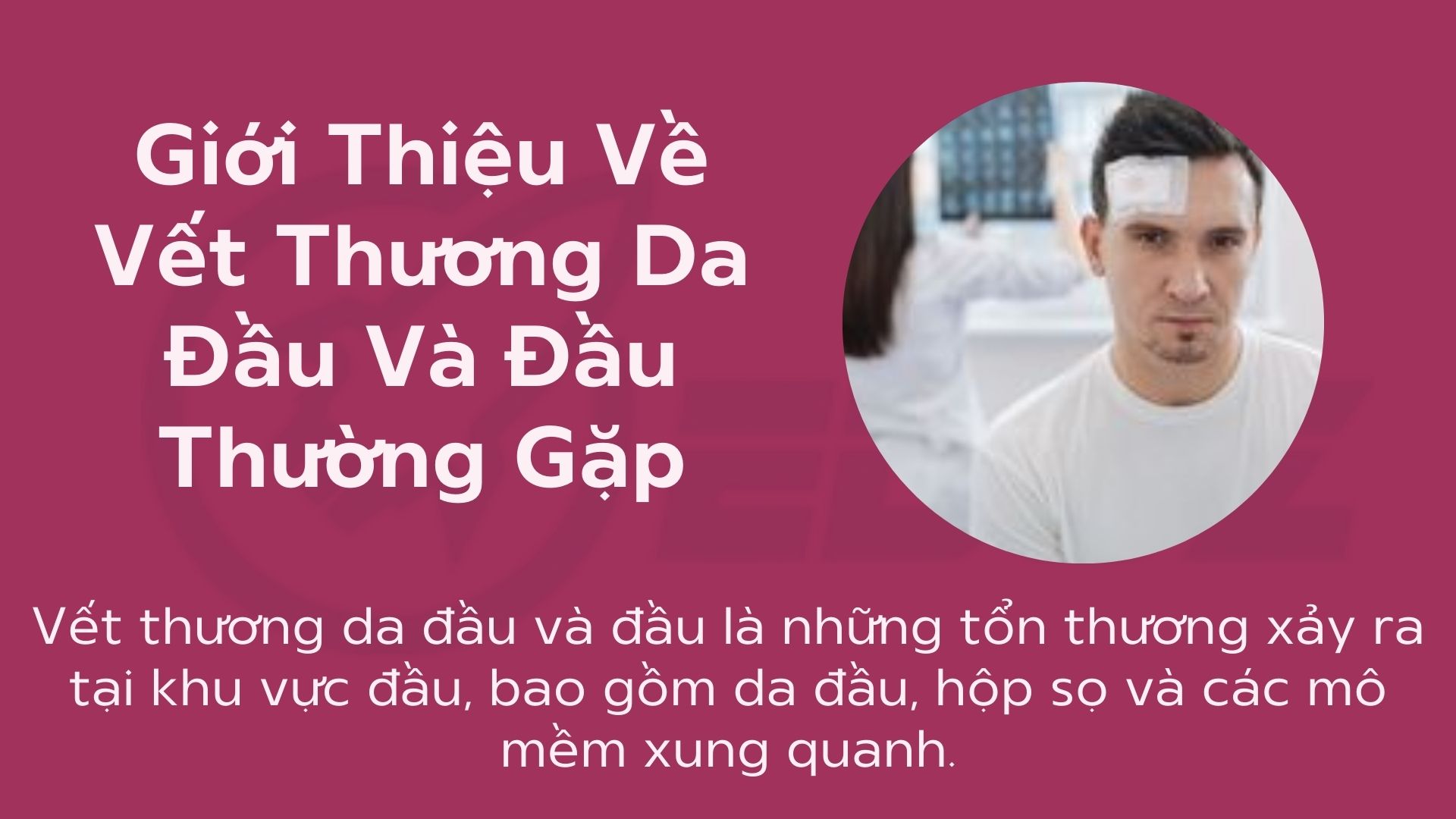 1.Giới thiệu về vết thương da đầu và đầu thường gặp